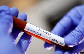 О ситуации по коронавирусной инфекции в Казахстане