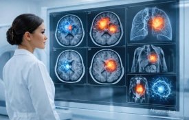 Минздрав планирует масштабировать применение ии-сервисов для диагностики инсульта и онкозаболеваний