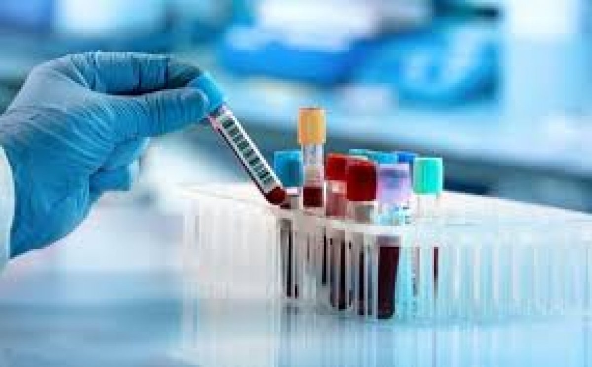 1,5 млн. тестов проведено по стране