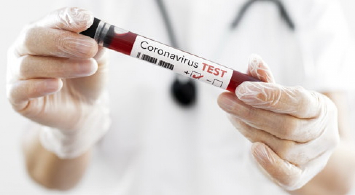 А. Цой: ситуация с заболеваемостью COVID-19 стабилизировалась